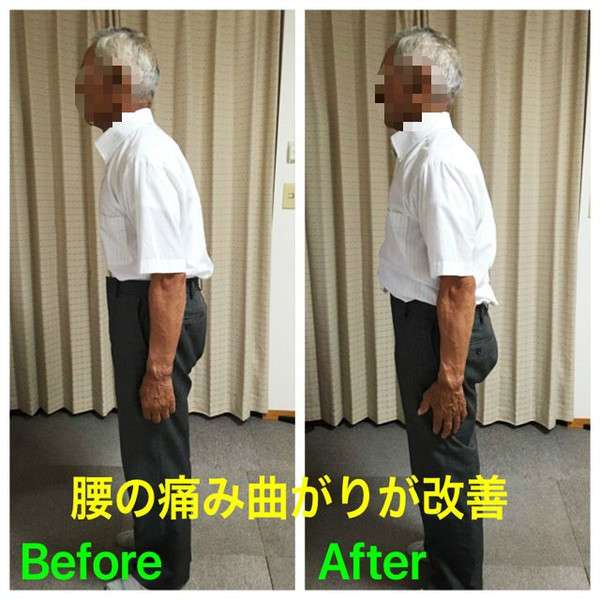 腰の痛み曲がりが改善